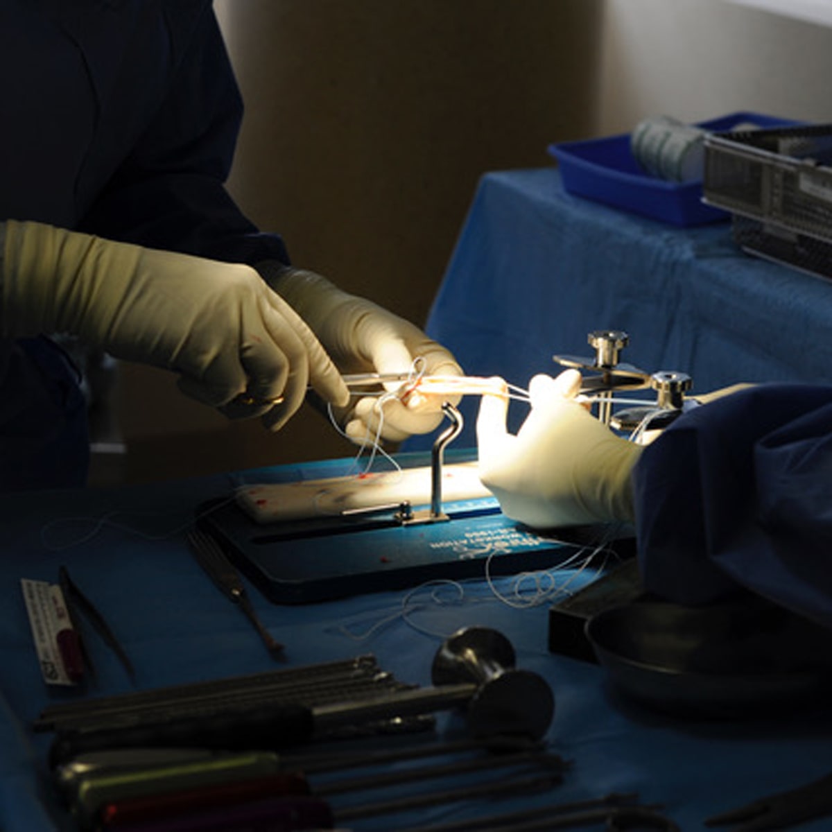 © Ortho Health Institut in München Zwei behandschuhte Hände führen unter hellem Licht einen chirurgischen Eingriff an einem medizinischen Gerät durch. Auf einem mit blauen Tüchern bedeckten Tisch rund um das Gerät liegen verschiedene chirurgische Instrumente. Der Hintergrund ist schwach beleuchtet, man sieht medizinische Geräte und Tabletts, typisch für das Ortho Health Institut in München.