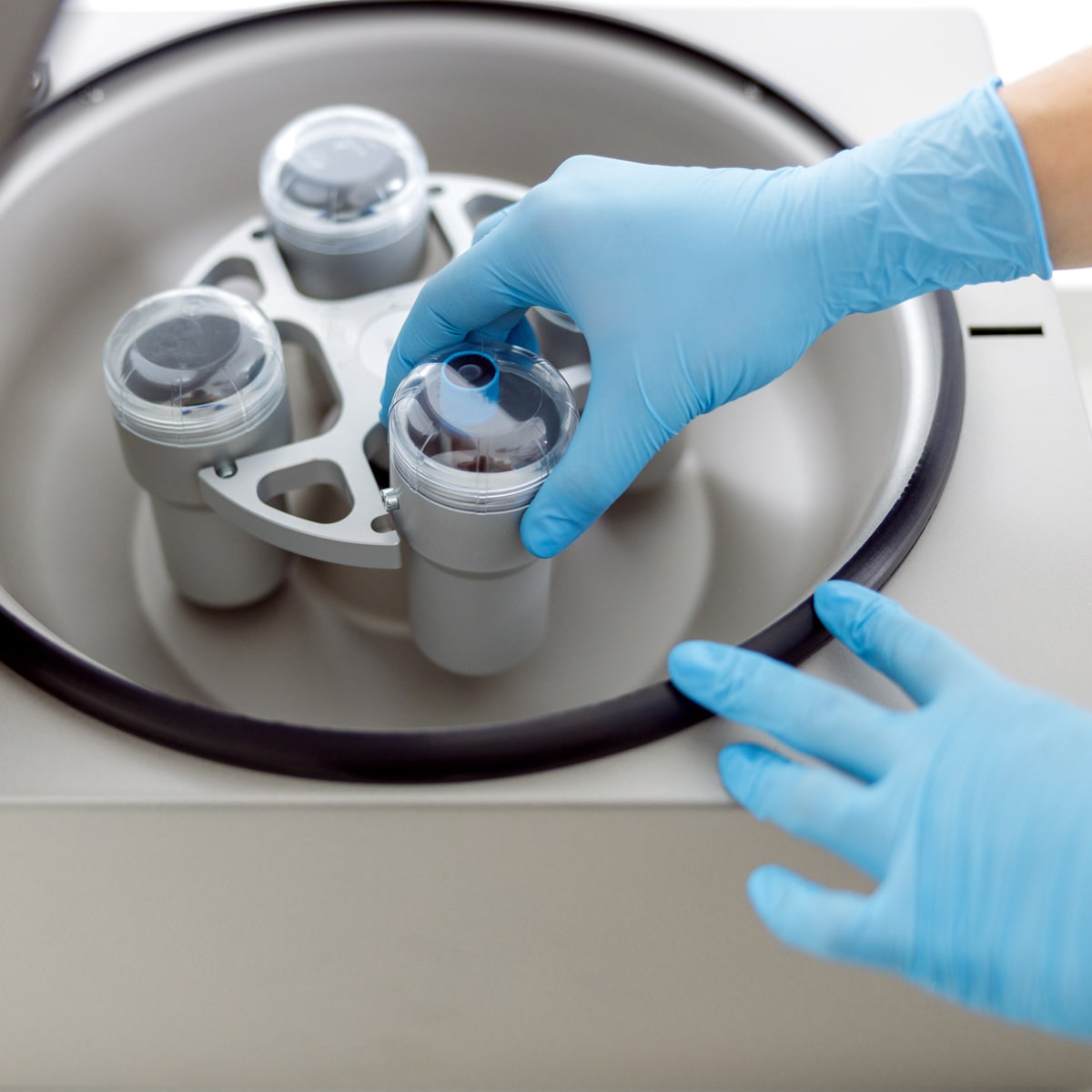 © Ortho Health Institut in München Eine Person mit blauen Handschuhen stellt einen transparenten Behälter in eine Zentrifuge im Ortho Health Institut in München. Die Zentrifuge, die mit mehreren Einschüben für Behälter ausgestattet ist, steht in einer aufwendigen Laborumgebung.