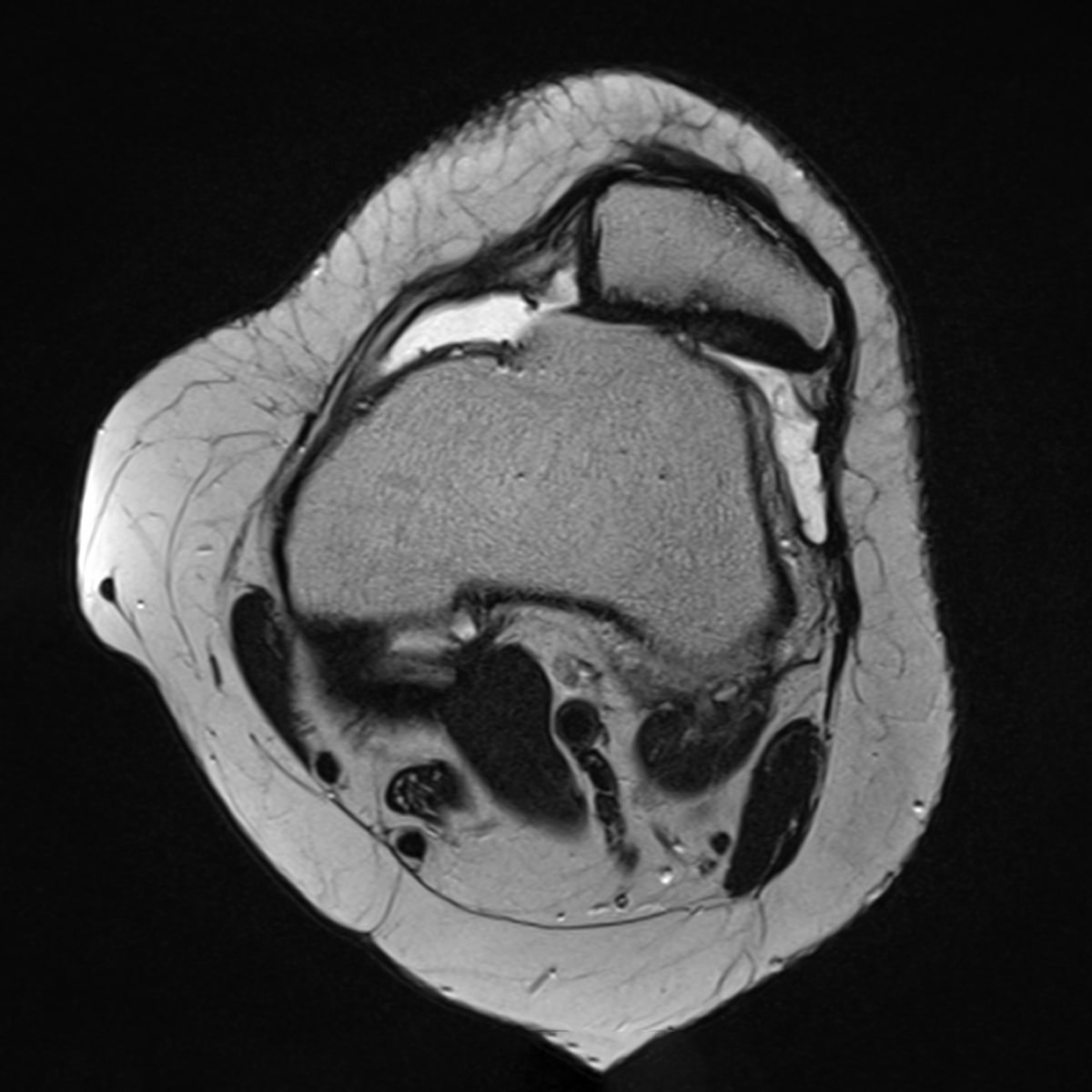 Ein schwarz-weißer MRT-Scan des Ortho Health Instituts in München zeigt eine Querschnittsansicht eines Kniegelenks. Verschiedene Gewebe und Strukturen wie Muskeln, Sehnen und Knochen sind in unterschiedlichen Grautönen sichtbar. Das Bild hebt die komplexe innere Anatomie des Knies hervor.